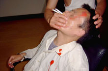 酷刑演示：將兩根煙同時點著插入法輪功學員的鼻孔，把嘴捂住。熏嗆、窒息極為痛苦。