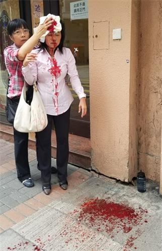 '圖：二零一九年九月二十四日下午約四點左右，法輪功學員廖秋蘭在長沙灣警署附近被襲擊，頭部受傷。'