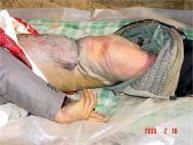 '遺體令人慘不忍睹，後背被電棍電的紫黑、潰爛，腰部、臀部傷痕累累。'