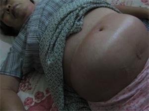 '劉曉蓮被迫害得全身浮腫、奄奄一息'